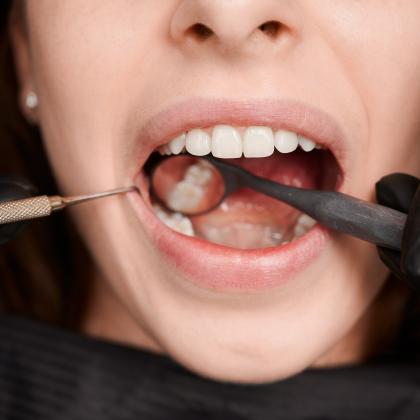 Wisdom Tooth Surgery: Reasons, Procedure, and Recovery