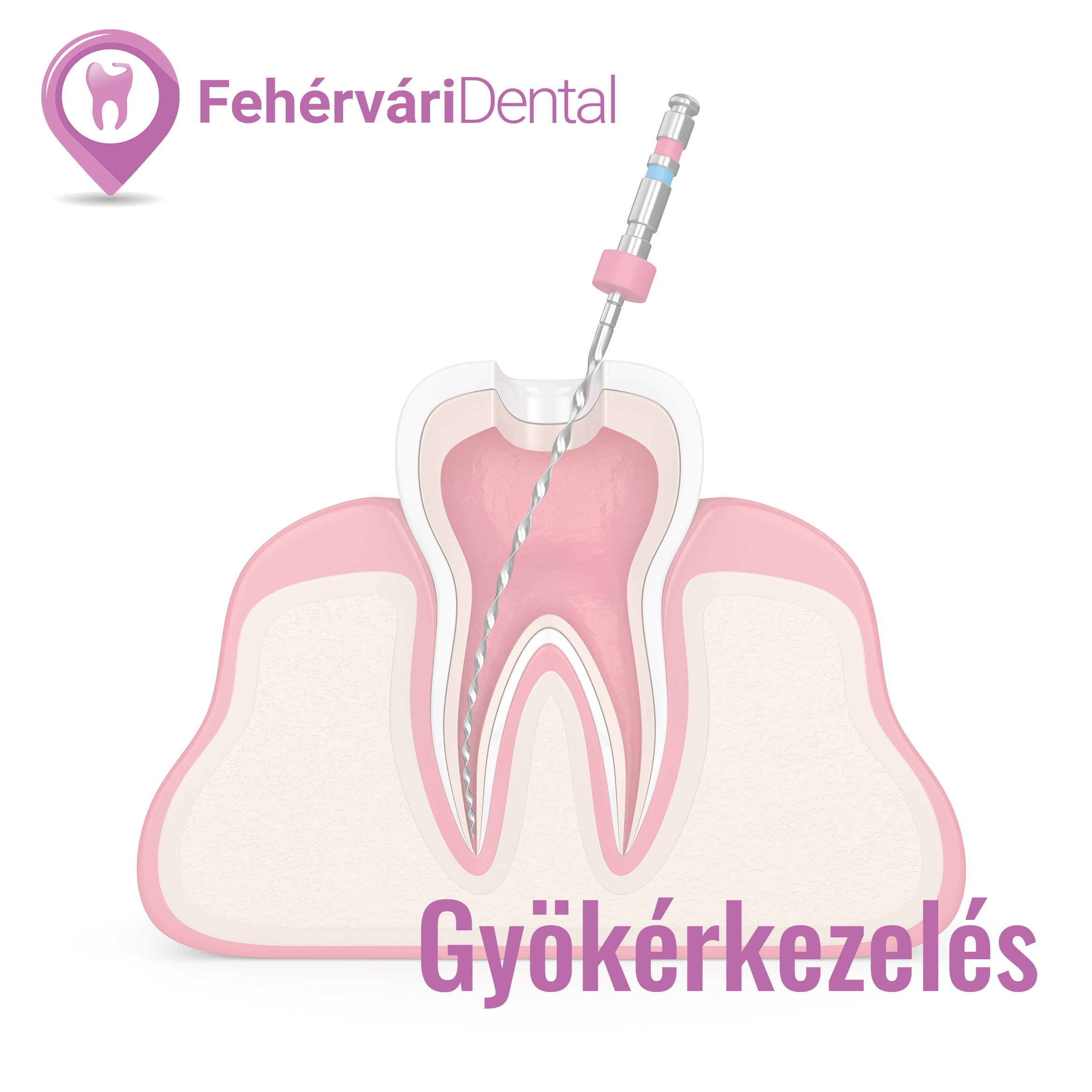 Gy k rkezel s Feh rv ri Dental Fog szat Budapest